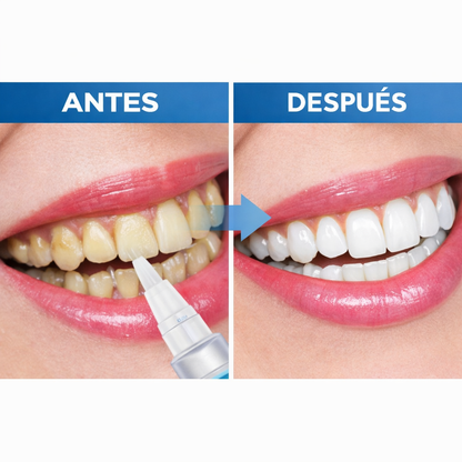 LumaDent™ Lápiz Blanqueador de Dientes - Sonrisa Blanca en Casa