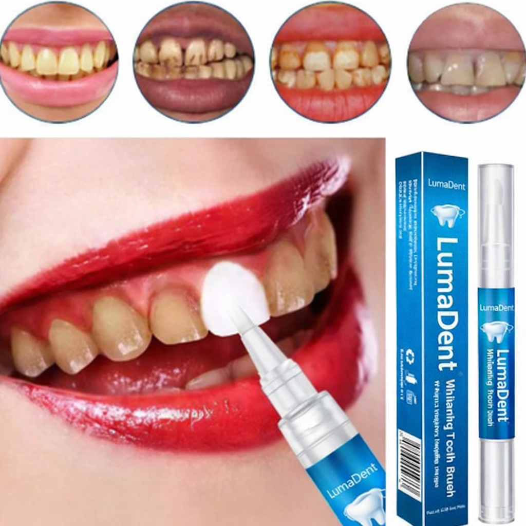 LumaDent™ Lápiz Blanqueador de Dientes - Sonrisa Blanca en Casa
